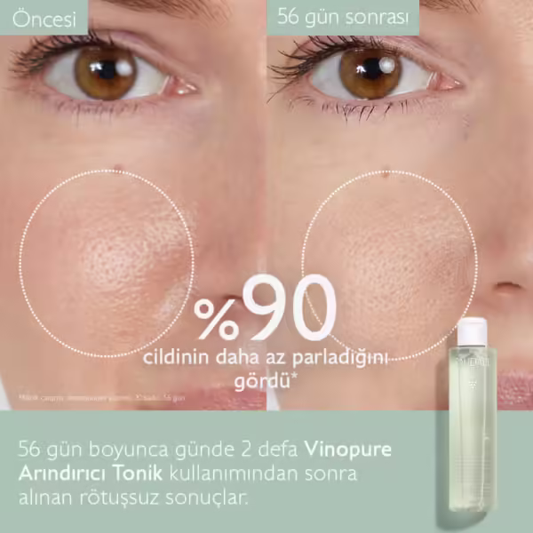 CAUDALIE Vinopure Akne Karşıtı Arındırıcı Tonik-200ml - Görsel 2