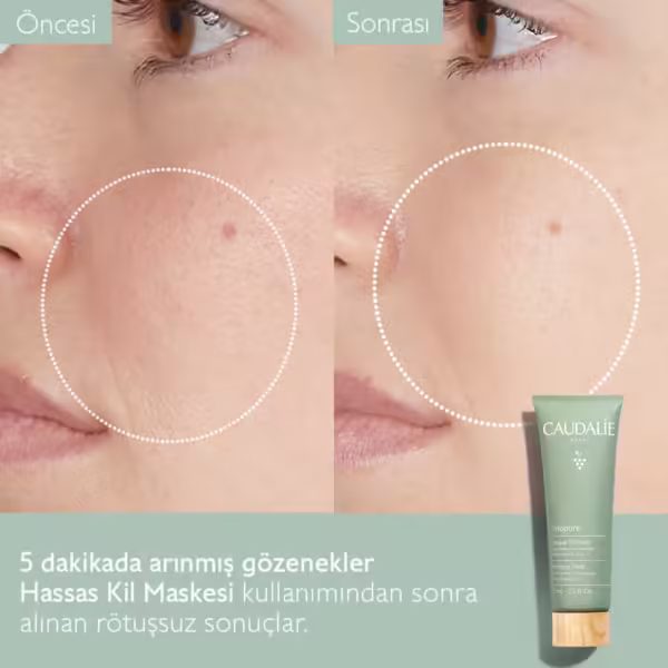 CAUDALIE Vinopure Hassas Kil Maskesi - Görsel 2